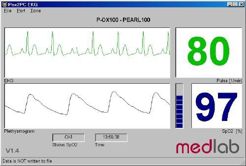 Vital sign telemonitoring software MEDLAB medizinische Diagnosegeräte