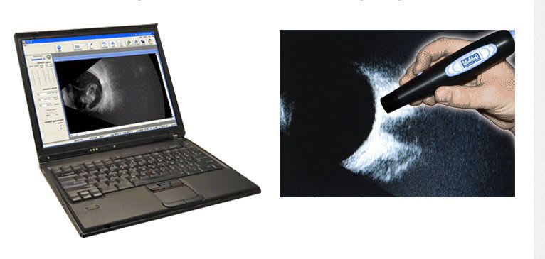 Hand-held ultrasound system / for ophthalmic ultrasound imaging / all-in-one probe MOBILE B-SCAN Micro Medical Devices