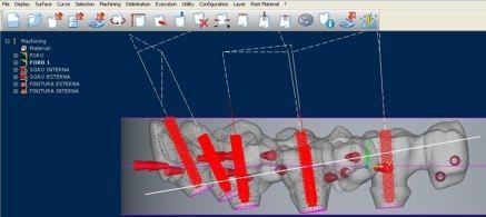 Prosthesis fabrication software / CAM / medical / dental iCAM V5 imes-icore GmbH