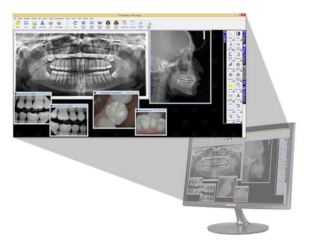 Analysis software / viewing / for dental imaging / dentist office LED Dental
