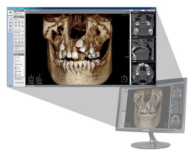 Analysis software / 3D viewing / for dental imaging / dental Xelis 3D LED Dental