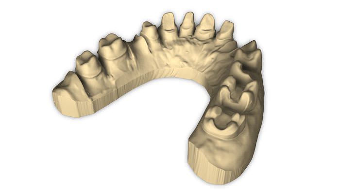 Dental laboratory dental CAD CAM scanner Scan 100 Laserdentium