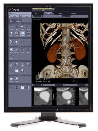 High-definition display / LCD / medical 21.3", 14 bit | D213Q5 Kostec