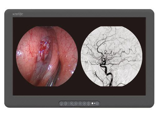 LCD display / high-definition / surgical 27", 4 MP, 14 bit | E270HBE Kostec