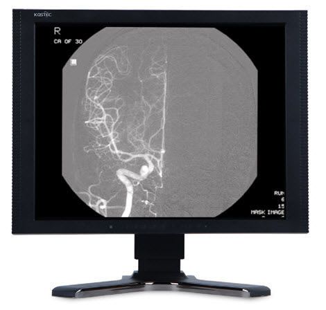 LCD display / medical 17", 12 bit | 150EX Kostec