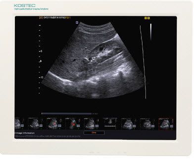 Diagnostic software / viewing / for ultrasound imaging / medical KT-U170S Kostec