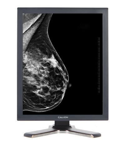 Monochrome display / LCD / high-definition / medical 21.3", 14 bit | Calion D213V5E Kostec