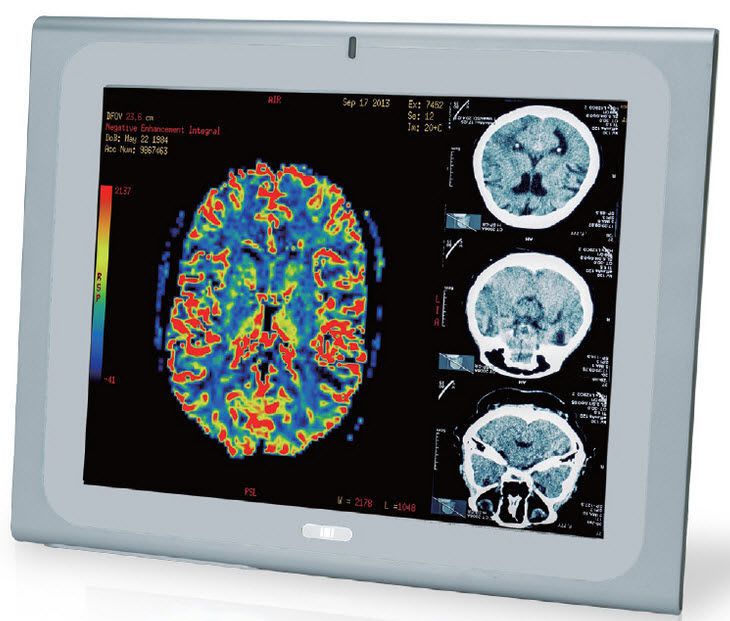 Medical panel PC 17", Intel® Core™ i7/i5/i3 | POC-17i-HM55 IEI