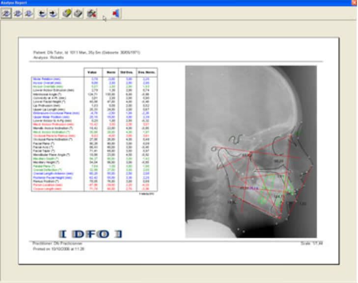 Cephalometric analysis software / medical Mediadent DFO IMAGELEVEL