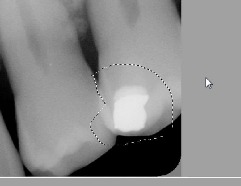 Dental implant simulation software / medical Mediadent v6 IMAGELEVEL