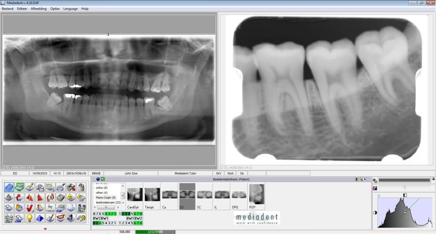 Medical software / for dental imaging Mediadent IMAGELEVEL