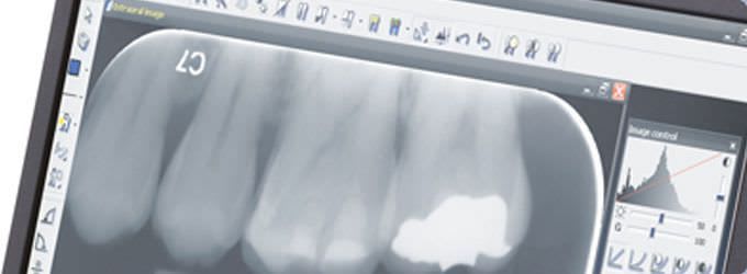 Medical software / for dental imaging CLINIVIEW™ Instrumentarium Dental