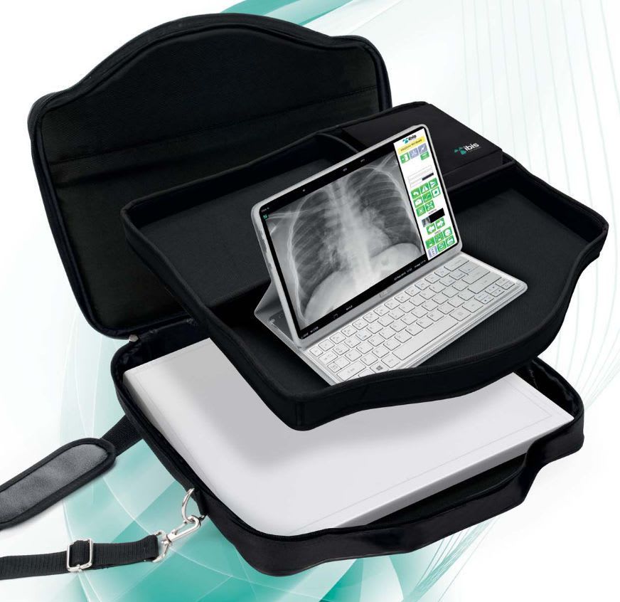 Digital medical radiography acquisition system / for radiography / portable EASY IBIS