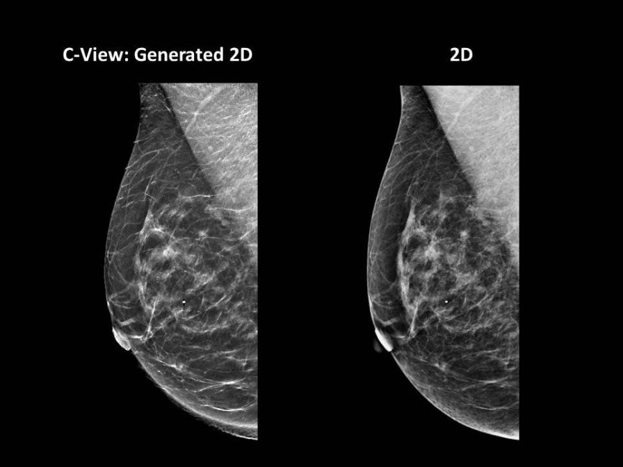 Diagnostic software / viewing / medical / for mammography C-View™ Software Hologic