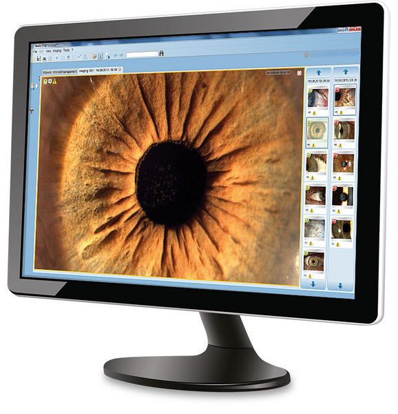 Management software / image capture / ophthalmology / medical EyeSuite™ Haag-Streit Diagnostics