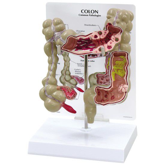 Colon anatomical model 3340 GPI Anatomicals