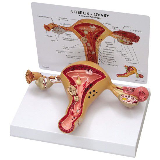Ovary anatomical model / uterus GPI Anatomicals
