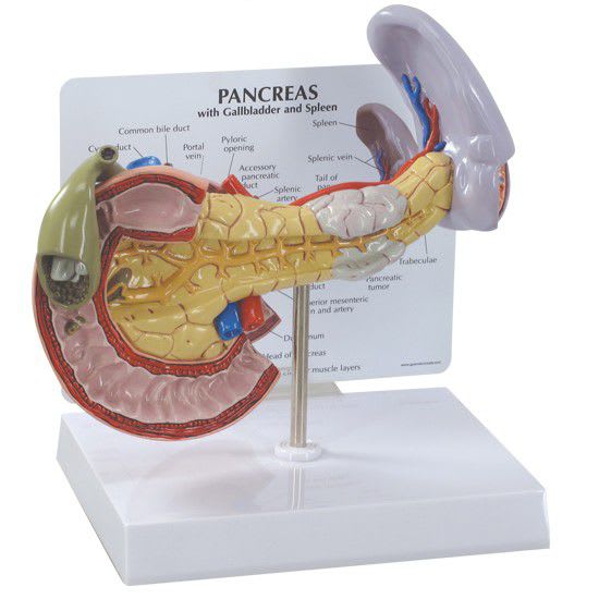 Pancreas pathology anatomical model 3330 GPI Anatomicals