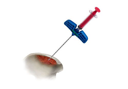 Bone marrow aspiration needle RETRIEVE® Globus Medical