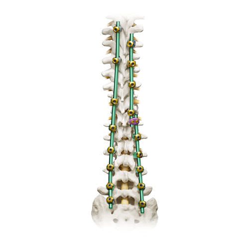 Thoraco-lumbar spinal osteosynthesis unit / posterior PROTEX® Globus Medical