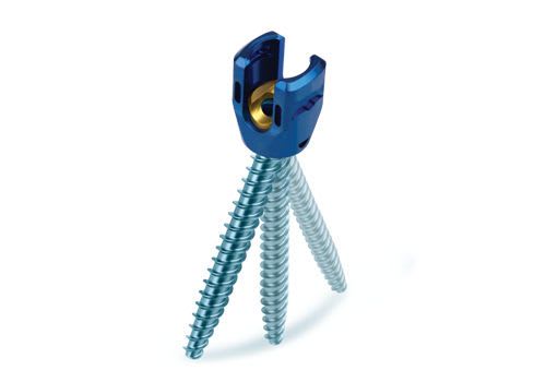 Polyaxial pedicle screw / not absorbable REVERE® Globus Medical
