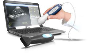 Portable ultrasound system / for abdominal and pelvic ultrasound imaging ClearProbe™ GlobalMed