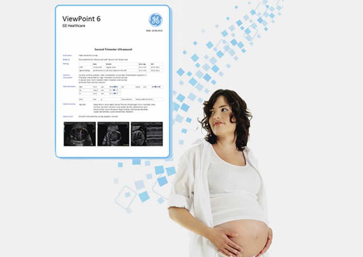 Analysis software / medical / for ultrasound imaging / EMR ViewPoint GE Healthcare