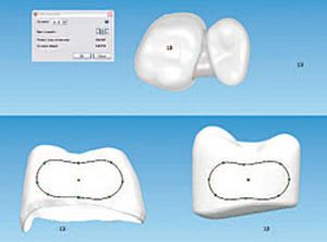 Dental prosthesis design software / CAM / CAD / medical Bien-Air Dental