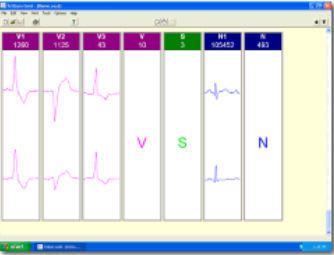 Analysis software / medical / Holter monitor Trillium Platinum Forest Medical