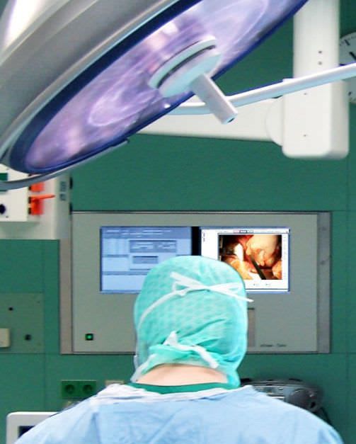 Digital camera / for operating theaters / high-definition ChromoVision HD-SDI Berchtold