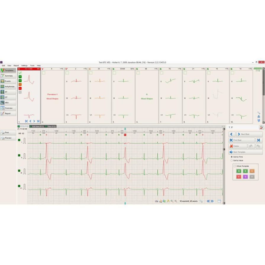 7-channels cardiac Holter monitor BTL CardioPoint-Holter H300 BTL International