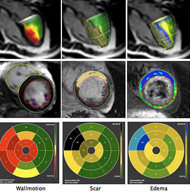 Diagnostic software / viewing / medical / cardiology CVI42 Circle Cardiovascular Imaging