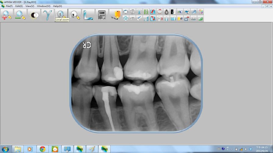 Medical software / for dental imaging Apixia Digital Imaging Apixia Inc.