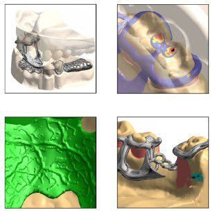 3D viewing software / CAD / for dental imaging Digistell Shining 3D