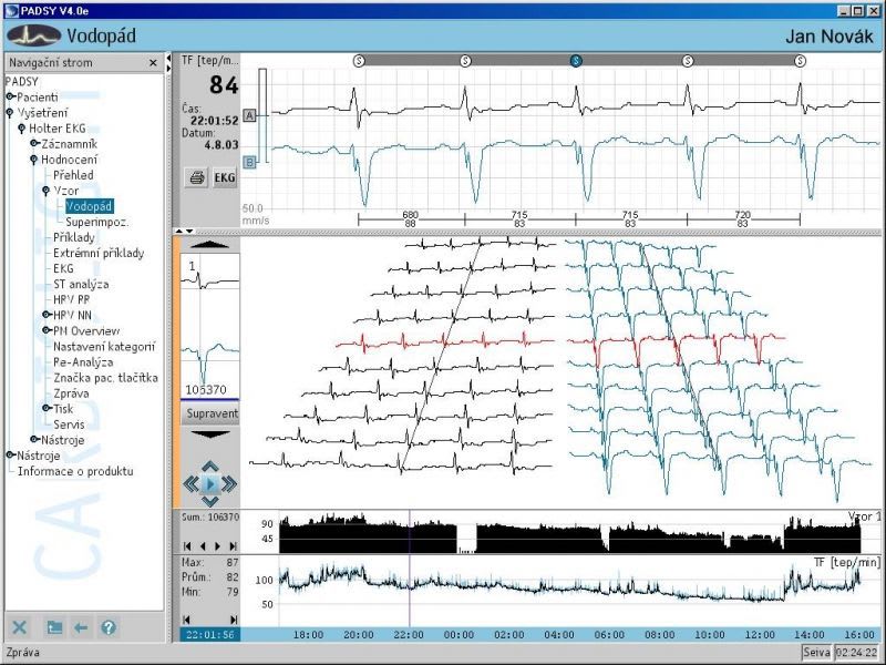 Cardiac Holter monitor Cardio Track Seiva