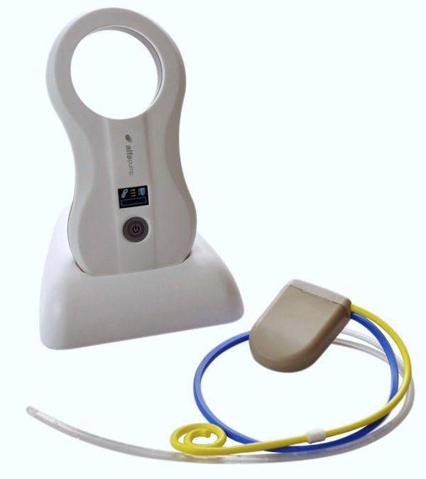 Peritoneal cavity pump implantable The alfapump® System Sequana Medical