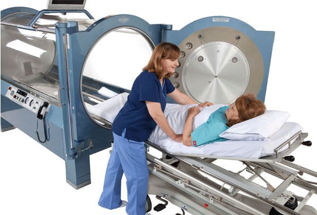 Monoplace hyperbaric chamber Sechrist 3600H Sechrist Industries, Inc.