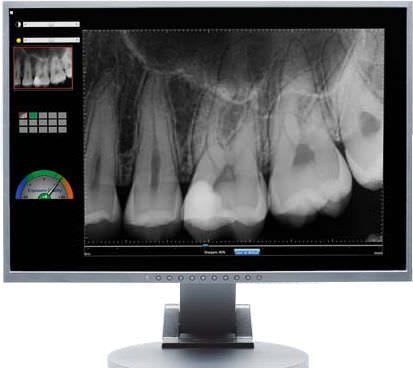 Dental radiography flat panel detector Schick 33 SCHICK TECHNOLOGIES,INC.