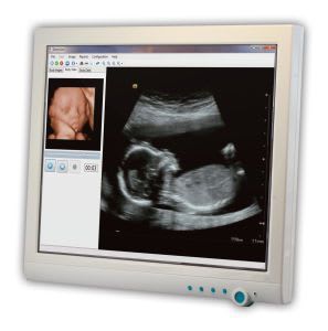 Medical panel PC with touchscreen / fanless 17", Dual Core 1.8 GHz | ONYX-1721 Onyx Healthcare Inc