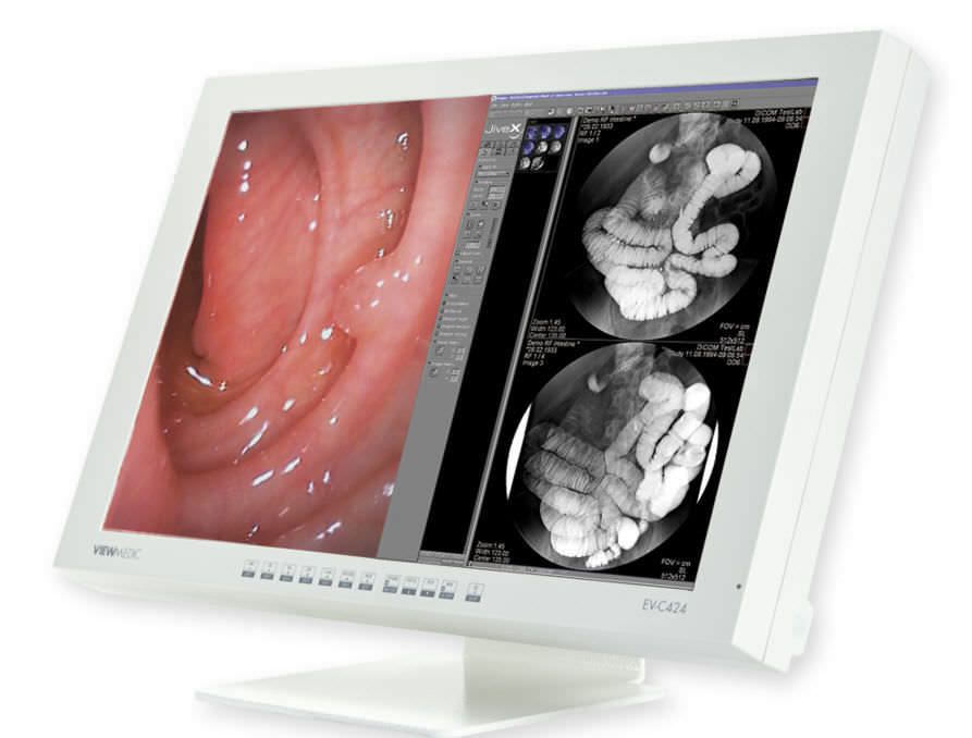 LCD display / medical 24" | VIEWMEDIC EV-C 424 Rein EDV - MeDiSol