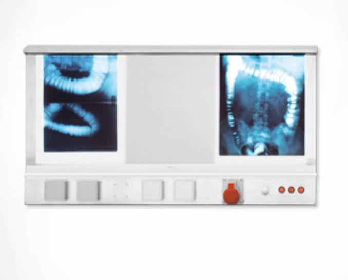 Digital X-ray film viewer / 3-section / with switch Psiliakos Leonidas
