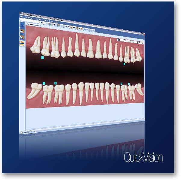 Diagnostic software / control / import / for dental imaging Quickvision OWANDY