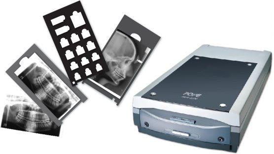 Dental radiographic films X-ray film scanner MEDI-2200 Po Ye X-Ray