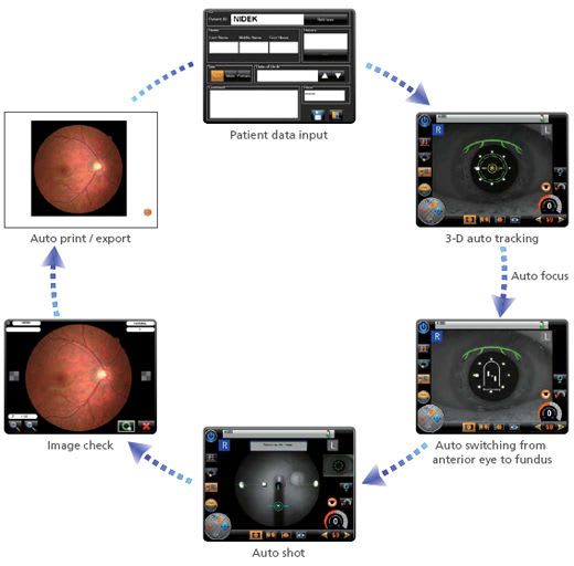 Non-mydriatic retinal camera (ophthalmic examination) AFC-330 NIDEK