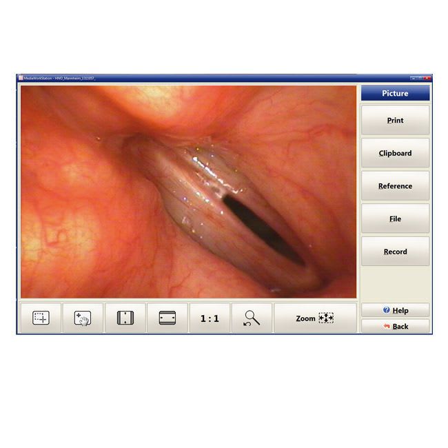 Laryngoscope video endoscope RS1/RX1 orlvision
