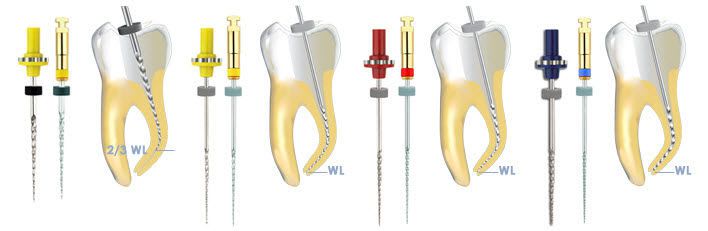 Root canal desobturation dental file HERO Shaper® Micro-Mega