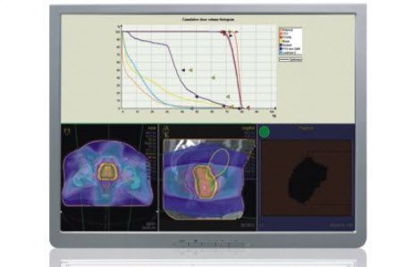 Planning software / for brachytherapy / medical Oncentra® VMAT Nucletron