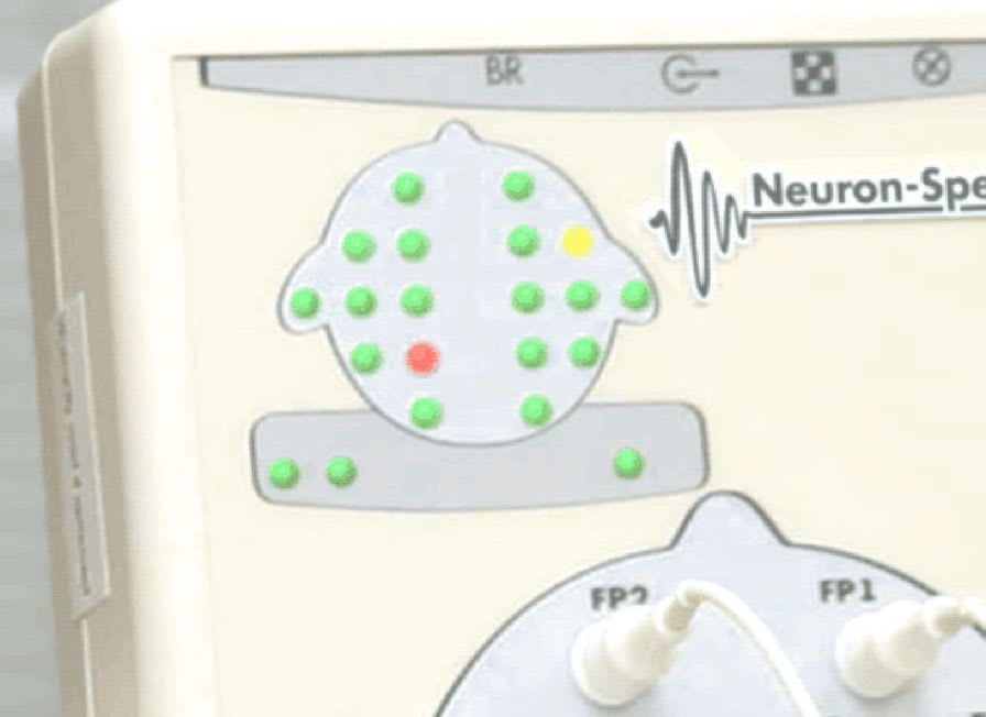 21-channel EEG system Neuron-Spectrum-4/P Neurosoft