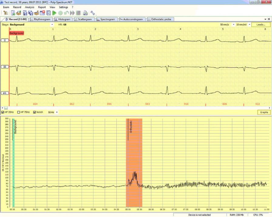 Analysis software / cardiovascular Poly-Spectrum-Rhythm Neurosoft