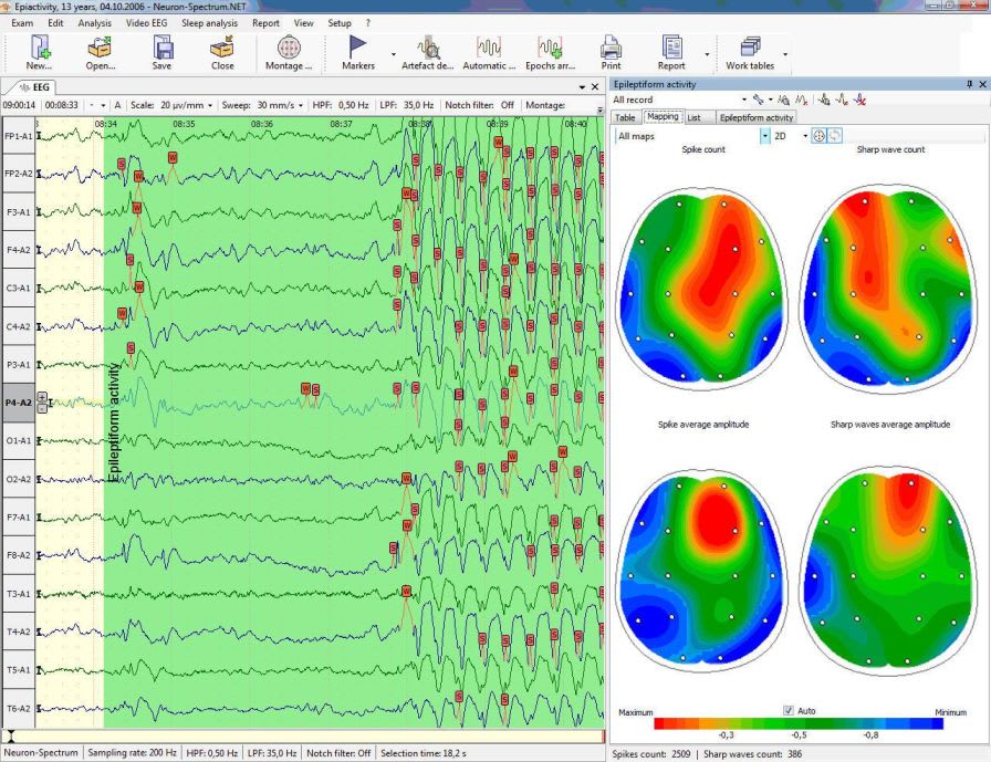 Electroencephalograph with evoked potential / 21-channel Neuron-Spectrum-4/EPM Neurosoft